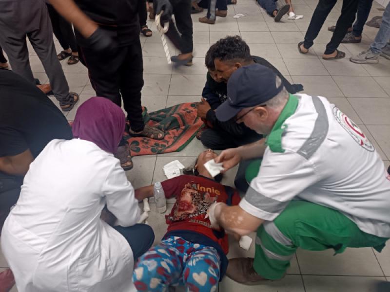 طفلة مصابة جلااء قصف الأحتلال