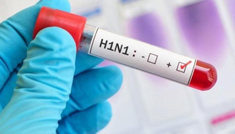 مصر تنفي انتشار إنفلونزا الخنازير وتؤكد خلوها من السلالات الجديدة للفيروسات التنفسية