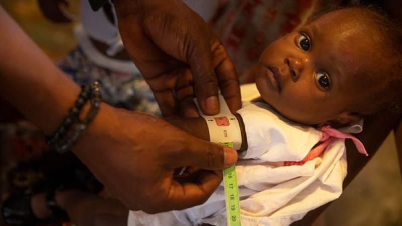 الأمم المتحدة تحذر: وباء الكوليرا يتفاقم على مستوى العالم