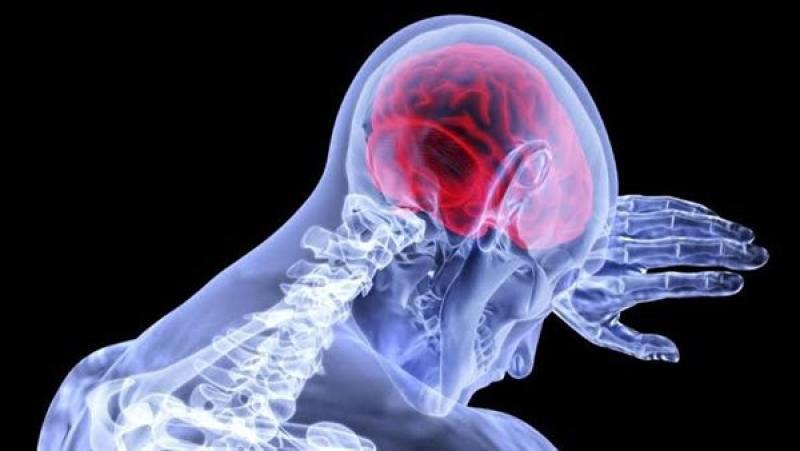 5 خطوات لتجنب الإصابة بالسكتة الدماغية.. تعرف عليها
