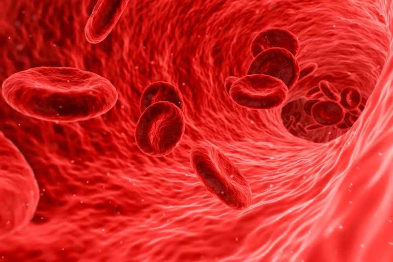 فقر الدم بسبب نقص الحديد: الأسباب والأعراض والعلاج