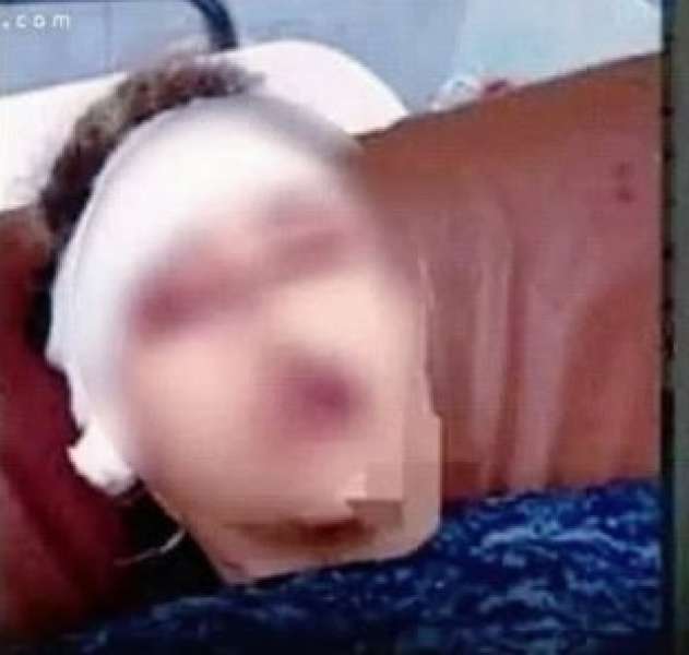 جريمة في حلوان : الزوجة  رفضت العمل فقطع الزوج  أذنها وطعنها 20 مرة