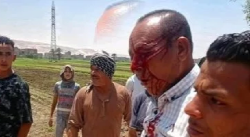 ”انفجار مقلة العين” تفاصيل التقرير الطبي لمسؤول حماية الأراضى بسوهاج