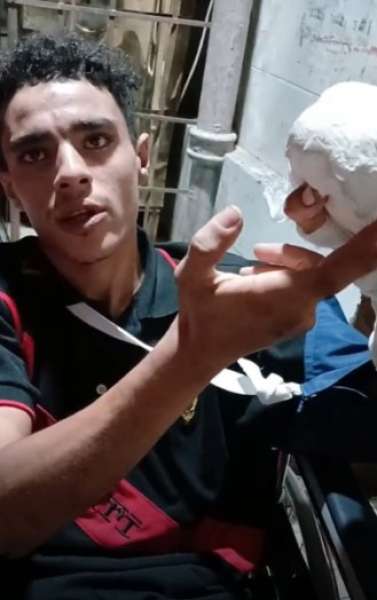 شاب يتصدى للبلطجة لحماية جارته.. فكان الثمن بتر أصابعه في الجيزة