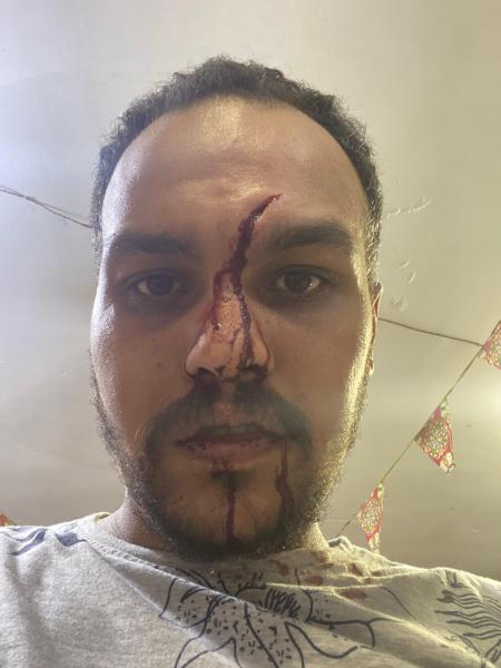 بلطجة في موقف البراجيل سائق يعتدي على مواطن بسلاح أبيض بسبب 5 جنيهات