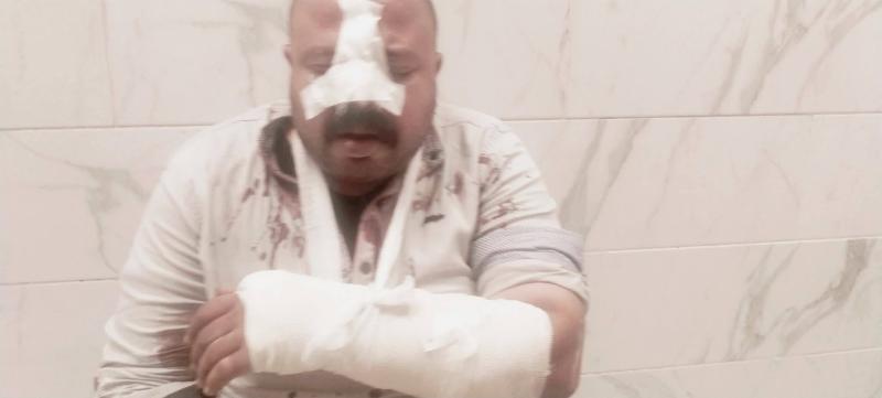 بموتوسيكل بدون ارقام علي الدائري: سرقة واعتداء وحشي على الطريق الدائري