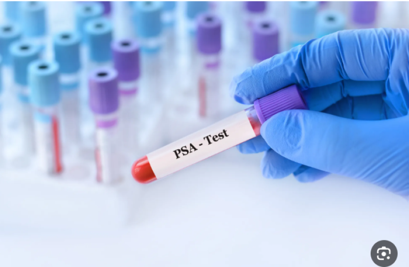 قصة DNA تهز تيك توك.. من محاولة فضح زوجة إلى اكتشاف سر صادم عن الحماة