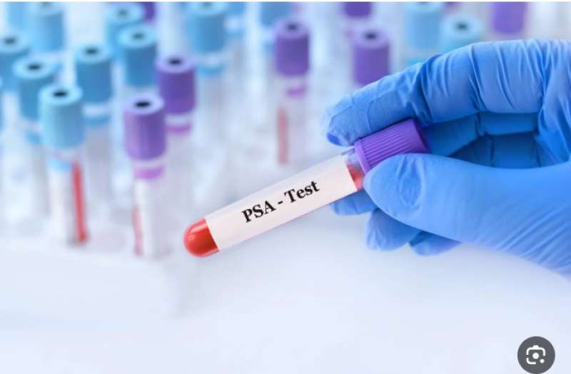 قصة DNA تهز تيك توك.. من محاولة فضح زوجة إلى اكتشاف سر صادم عن الحماة