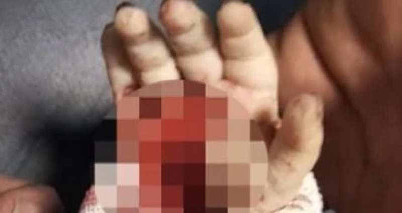مصرع رضيعة هزت سوهاج والطب الشرعي  «نهشتها عرسة».
