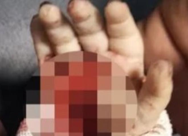 مصرع رضيعة هزت سوهاج والطب الشرعي  «نهشتها عرسة».