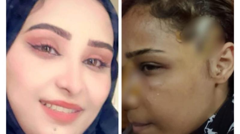 فضيحة على مواقع التواصل وجريمة تشويه.. القصة الكاملة لمعاناة فتاة أكتوبر