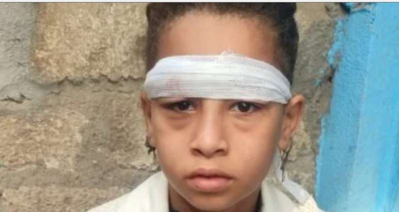 تكرار الاعتداءات يثير الرعب بين الطلاب.. إصابة تلميذة في مدرسة الحجيرات بقنا بطوبة من مجهول