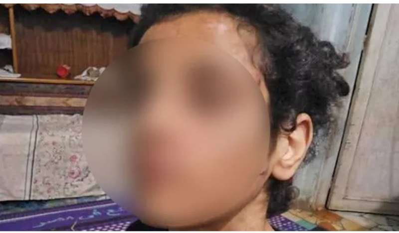 مأساة مروعة في قلب المنوفية: أب وزوجته يحوّلان منزل الطفلة إلى جحيم لا يطاق