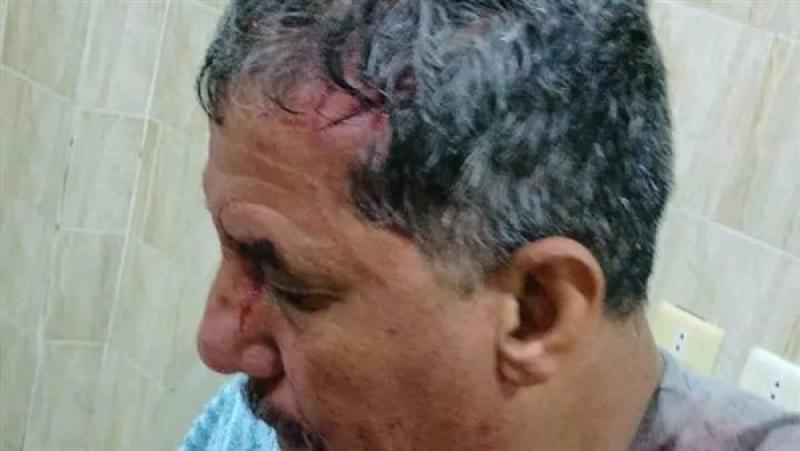 مشاجرة دامية في شارع المأذون بفاقوس.. إصابة رجل ونجله خلال محاولة التهدئة