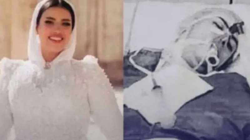 قبل الفرح.. عمليات تجميل سريعة تتحول لكوارث مروعة