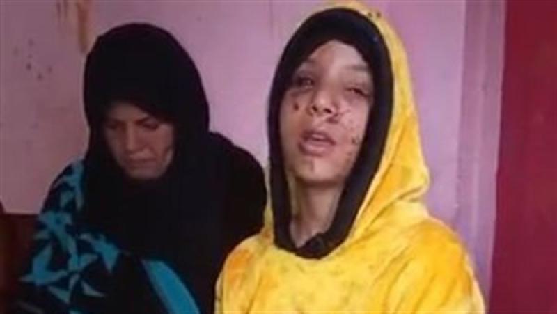 «كمين في طريق زراعي».. تفاصيل اعتداء وحشي على فتاة بالشرقية ومحاولة لتشويه وجهها
