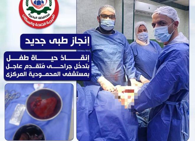 صحة البحيرة.. إنقاذ حياة طفل بتدخل جراحي متقدم عاجل بمستشفى المحمودية المركزي