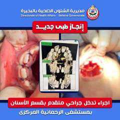 صحة البحيره | اجراء تدخل جراحي متقدم بقسم الأسنان بمستشفى الرحمانية المركزي