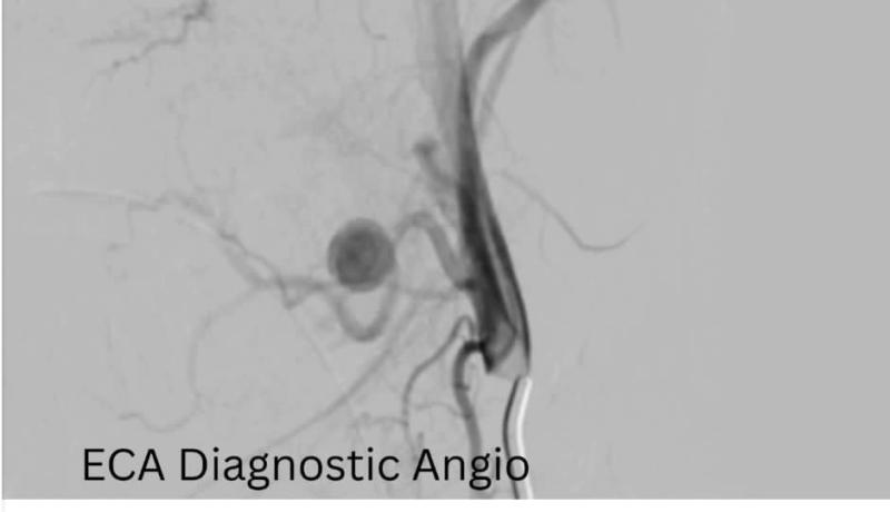 فريق طبي بمستشفيات سوهاج الجامعية ينقذ حياة طفلة وتغلق تمددا شريانيا نازفا دون جراحة