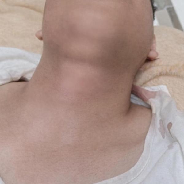 تدخل فوري من أطباء مستشفي الطوارئ بجامعة سوهاج ينقذ حياة شاب تعرض لاصابات بالغه وجروح متهتكة ونزيف حاد