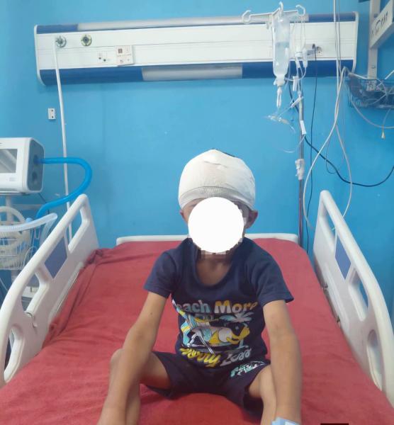 معجزة طبية بمستشفيات سوهاج الجامعية .. استخراج رصاصة طائشه من مخ طفل وإنقاذه دون مضاعفات